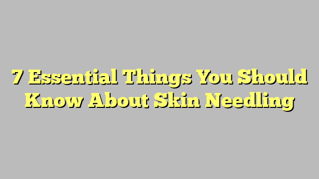7 Essential Things You Should Know About Skin Needling