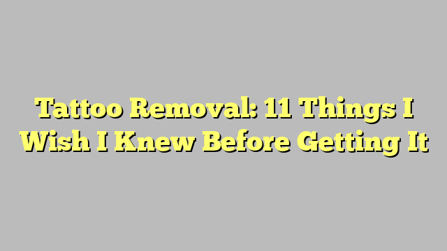 Tattoo Removal: 11 Things I Wish I Knew Before Getting It