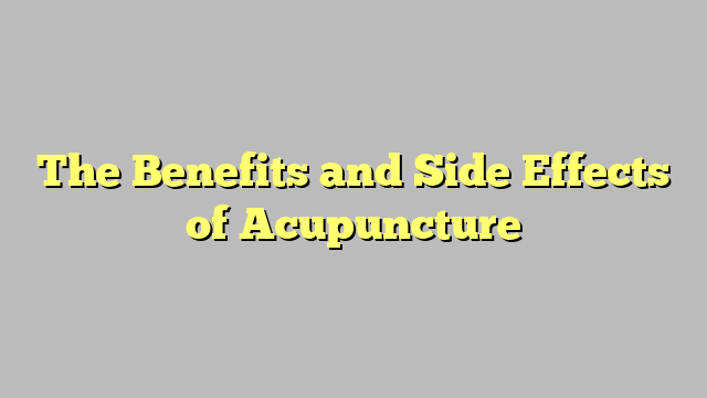 The Benefits and Side Effects of Acupuncture