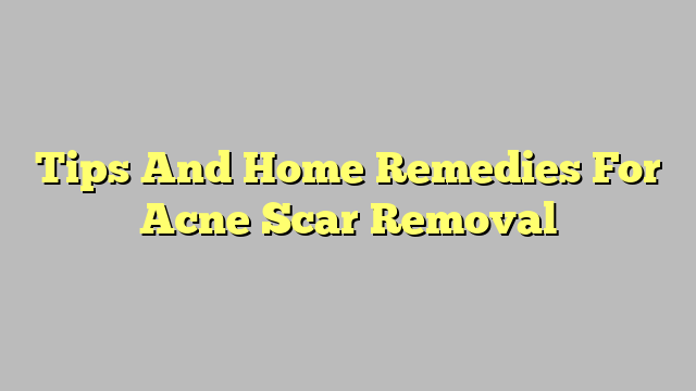 Tips And Home Remedies For Acne Scar Removal