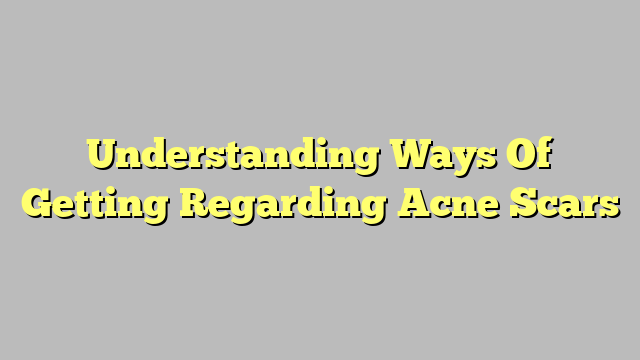 Understanding Ways Of Getting Regarding Acne Scars